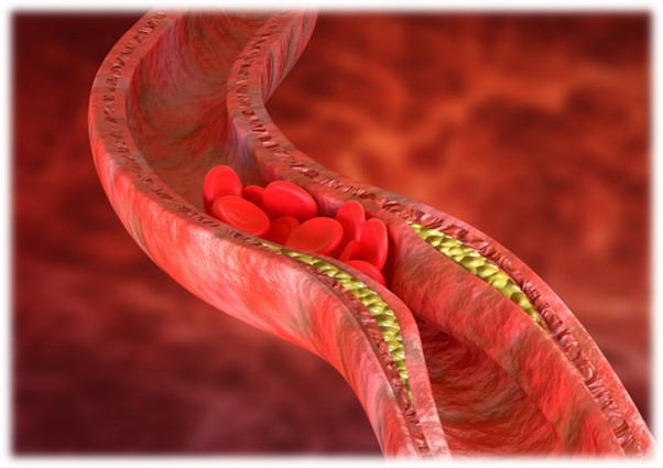 אסטקסנטין ומחלות אוטואימוניות ולב