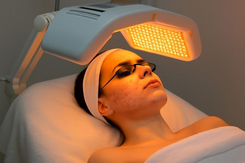 Phototherapy for acne treatment